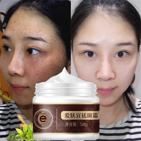 Whitening Facial Cream Repair Fade Freckles Remove Dark Spots Melanin Brightening Face Cream 50g Skin Care косметика