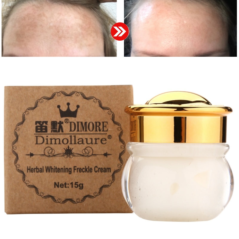Dimollaure Strong Removal melasma whitening cream Freckle speckle sunburn Spots pigment Melanin scar removal face cream Dimore