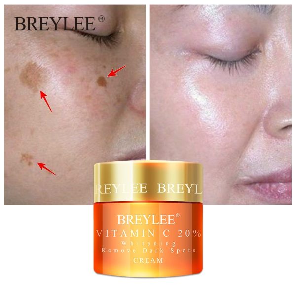 Breylee Vitamin C 20% Vc Whitening Facial Cream Repair Fade Freckles Remove Dark Spots Melanin Remover Brightening Face Care