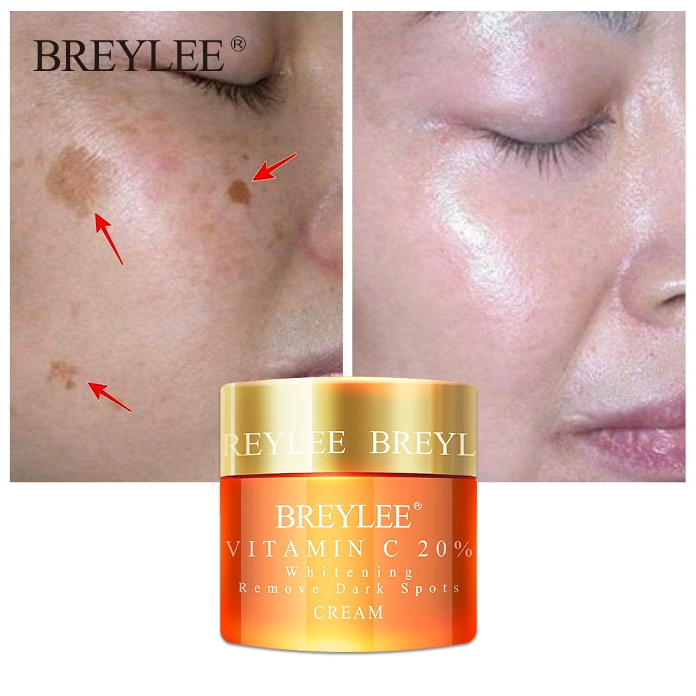 Breylee Vitamin C 20% Vc Whitening Facial Cream Repair Fade Freckles Remove Dark Spots Melanin Remover Brightening Face Care