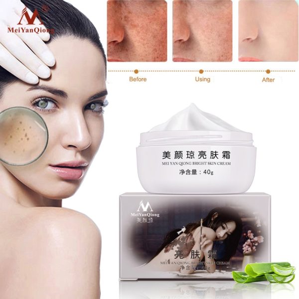 MeiYanQiong Strong Effects Powerful Whitening Freckle Cream 40g Remove Melasma Acne Spots Pigment Melanin Face Care Cream