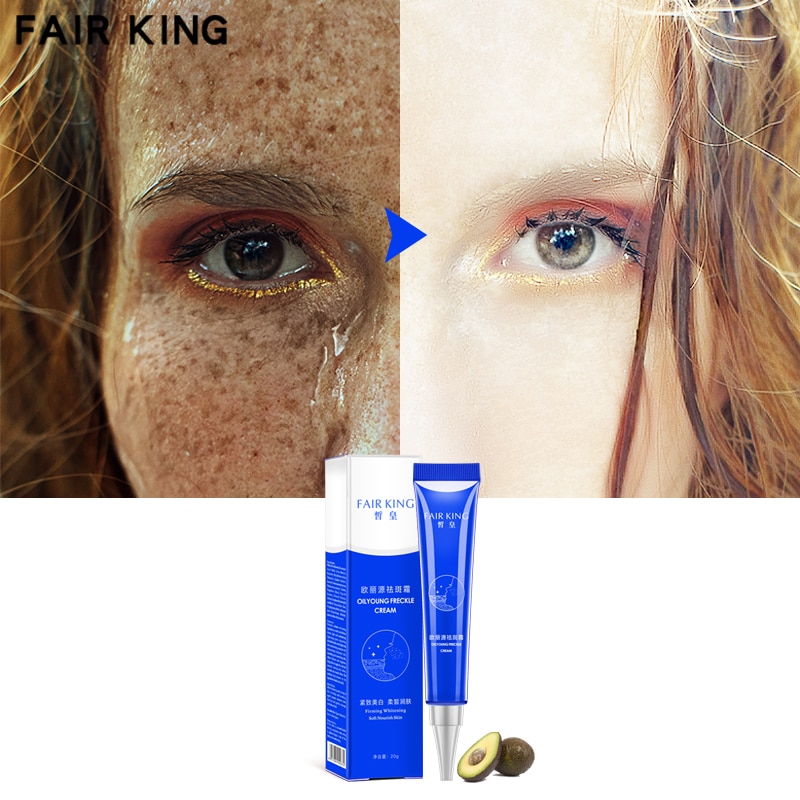 Effective Whitening Freckle Cream 20g Moisturizing Remove Melasma Acne Spots Treatment Pigment Melanin Whitening Skin CareTSLM2