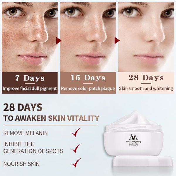 Powerful Whitening Freckle Cream 40g Remove Melasma Acne Spots Pigment Melanin Dark Spots Face Lift Firming Face Care Cream skin