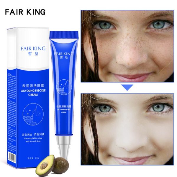 Effective Whitening Freckle Cream 20g Moisturizing Remove Melasma Acne Spots Treatment Pigment Melanin Whitening Skin CareTSLM2