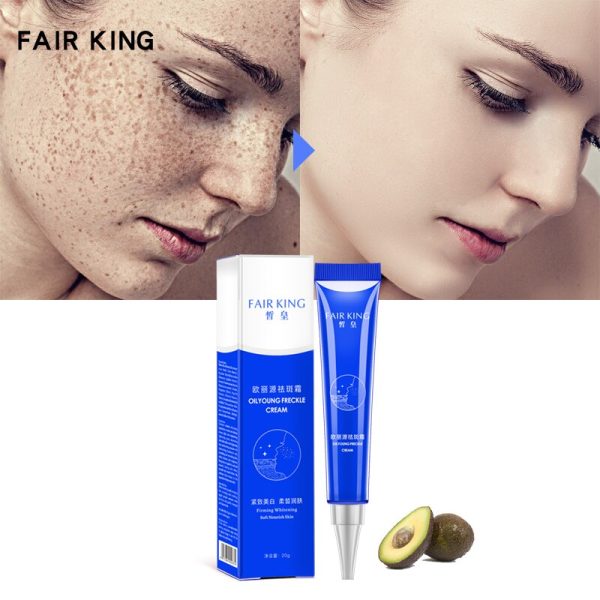 Effective Whitening Freckle Cream 20g Moisturizing Remove Melasma Acne Spots Treatment Pigment Melanin Whitening Skin CareTSLM2