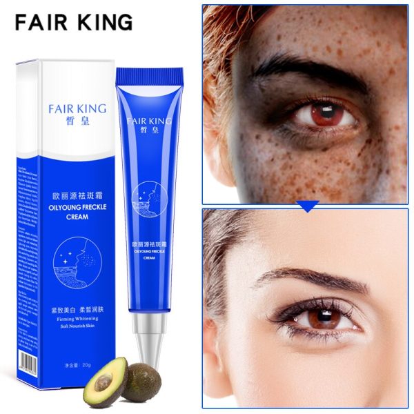 Effective Whitening Freckle Cream 20g Moisturizing Remove Melasma Acne Spots Treatment Pigment Melanin Whitening Skin CareTSLM2