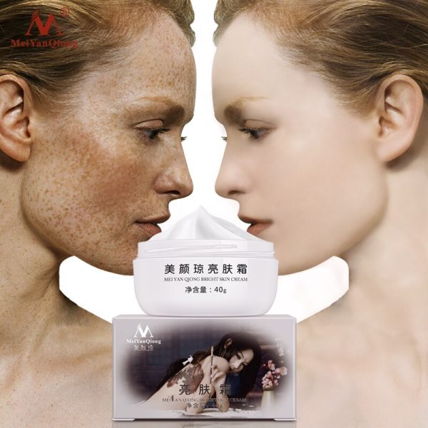 MeiYanQiong Strong Effects Powerful Whitening Freckle Cream 40g Remove Melasma Acne Spots Pigment Melanin Face Care Cream