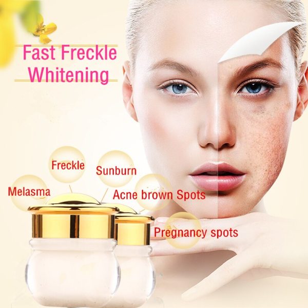 Dimollaure Strong Removal melasma whitening cream Freckle speckle sunburn Spots pigment Melanin scar removal face cream Dimore