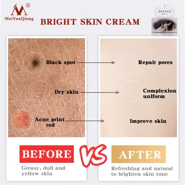MeiYanQiong Strong Effects Powerful Whitening Freckle Cream 40g Remove Melasma Acne Spots Pigment Melanin Face Care Cream