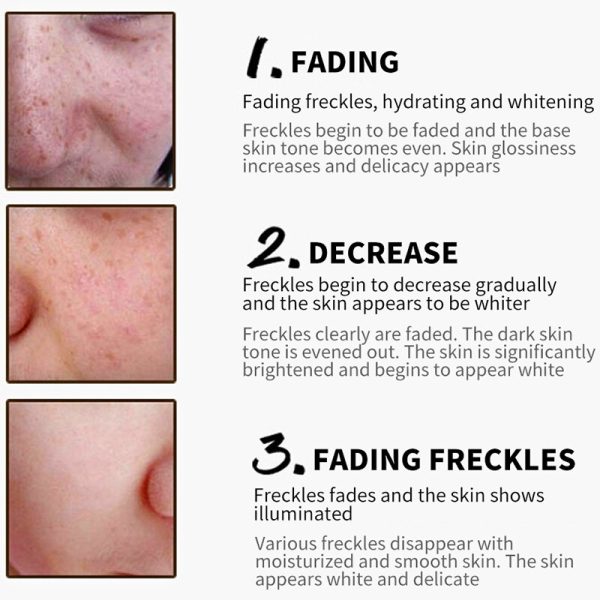 BEACUIR Hyaluronic Acid Freckles Whitening Face Cream Moisturizing Collagen Serum Brighten For Dark Yellow Skin Anti Aging Care