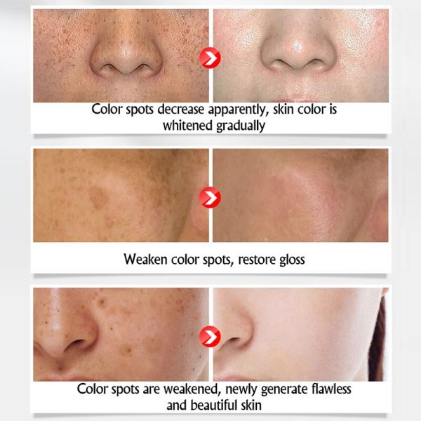 BEACUIR Hyaluronic Acid Freckles Whitening Face Cream Moisturizing Collagen Serum Brighten For Dark Yellow Skin Anti Aging Care