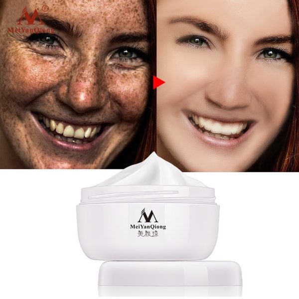 Powerful Whitening Freckle Cream 40g Remove Melasma Acne Spots Pigment Melanin Dark Spots Face Lift Firming Face Care Cream skin