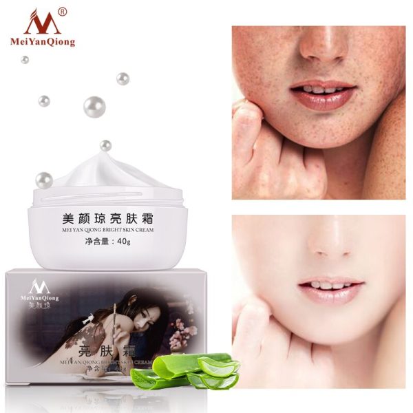 Powerful Whitening Freckle Cream 40g Remove Melasma Acne Spots Pigment Melanin Dark Spots Face Lift Firming Face Care Cream skin