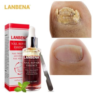 LANBENA Fungal Nail Repair Essence Serum Care Treatment Foot Nail Fungus Removal Gel Anti Infection Paronychia Onychomycosis