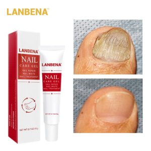 LANBENA Fungal Nail Repair Serum Care Treatment Foot Nail Fungus Removal Gel Anti Infection Paronychia Onychomycosis Essence