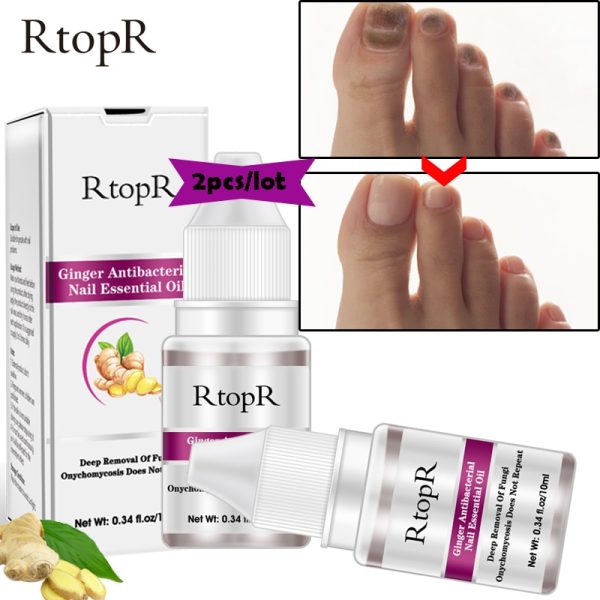 Professional Fungal Nail Treatment Feet Care Essence Foot Whitening Toe Nail Fungus Removal Gel Anti Care TSLM1