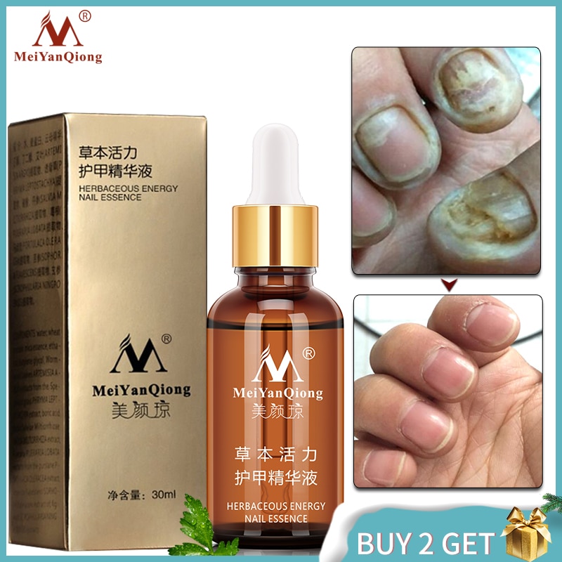 NEW!!!Fungal Nail Treatment Essence Nail and Foot Whitening Toe Nail Fungus Removal Feet Care Nail Gel Free Shipping