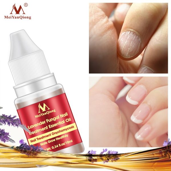 Meiyanqiong Lavender Fungal Nail Treatment Essential Oil Promote Nails Grow Healthy Nail Treatment Onychomycosis Foot Care