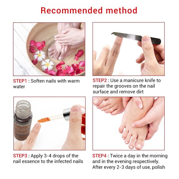 LANBENA Fungal Nail Repair Serum Care Treatment Foot Nail Fungus Removal Gel Anti Infection Paronychia Onychomycosis Essence