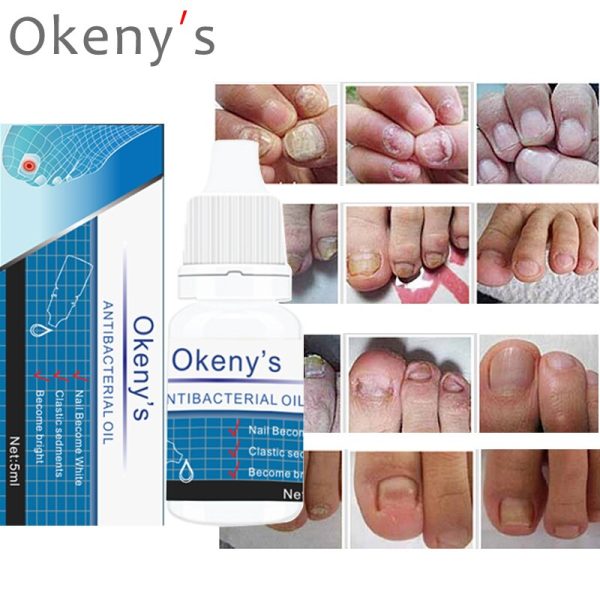 3 Days Effect Fungus Removal Essence Liquid Fungal Nail Treatment Bright Nail Repair Anti Infection Foot Caring Onychomycosis