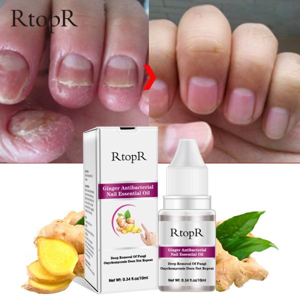 Professional Fungal Nail Treatment Feet Care Essence Foot Whitening Toe Nail Fungus Removal Gel Anti Care TSLM1